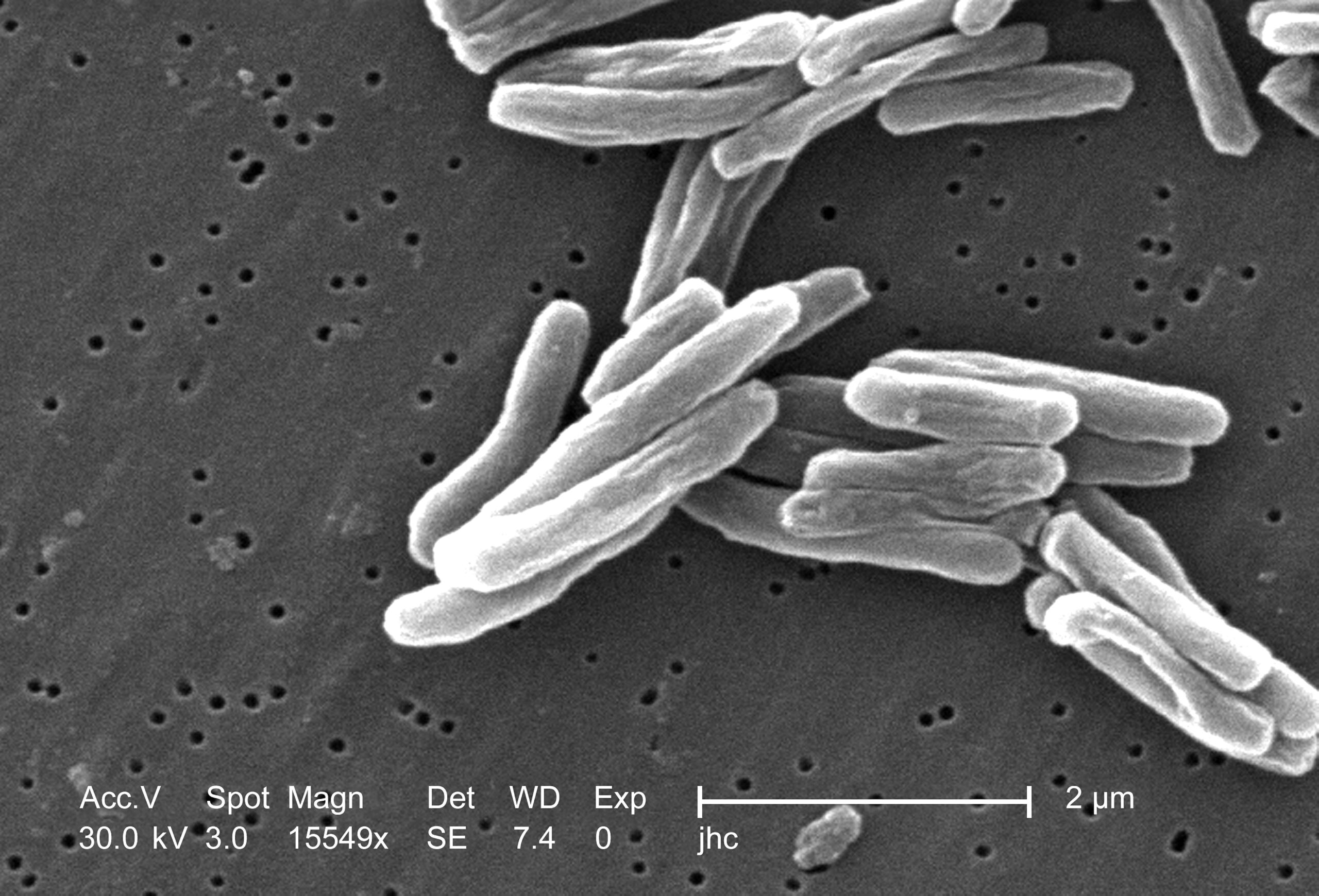 Fotografía de bacteria de tuberculosis